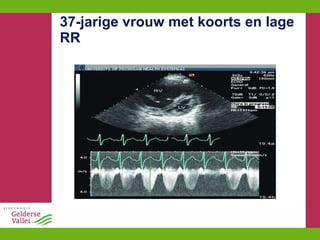 37-jarige vrouw met koorts en lage RR 