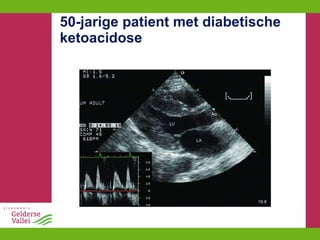 50-jarige patient met diabetische ketoacidose 