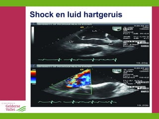 Shock en luid hartgeruis 