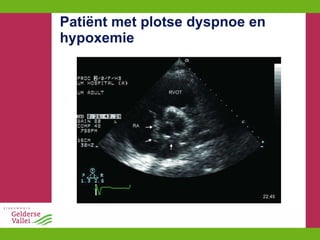 Patiënt met plotse dyspnoe en hypoxemie 