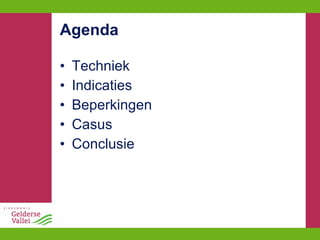 Agenda Techniek Indicaties Beperkingen Casus Conclusie 