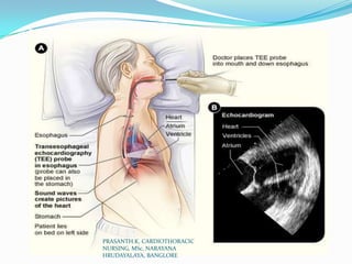 PRASANTH.K, CARDIOTHORACIC
NURSING, MSc, NARAYANA
HRUDAYALAYA, BANGLORE
 