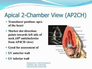 Apical 2-Chamber View (AP2CH)
 Transducer position: apex
of the heart
 Marker dot direction:
points towards left side of...