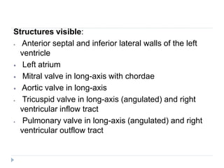 Structures visible:
⦁ Anterior septal and inferior lateral walls of the left
ventricle
⦁ Left atrium
⦁ Mitral valve in long-axis with chordae
⦁ Aortic valve in long-axis
⦁ Tricuspid valve in long-axis (angulated) and right
ventricular inflow tract
⦁ Pulmonary valve in long-axis (angulated) and right
ventricular outflow tract
 