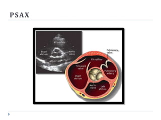 PSAX
 