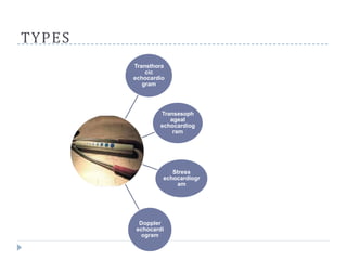 TYPES
Transthora
cic
echocardio
gram
Transesoph
ageal
echocardiog
ram
Stress
echocardiogr
am
Doppler
echocardi
ogram
 