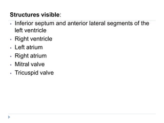 Structures visible:
⦁ Inferior septum and anterior lateral segments of the
left ventricle
⦁ Right ventricle
⦁ Left atrium
⦁ Right atrium
⦁ Mitral valve
⦁ Tricuspid valve
 