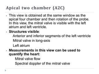Apical two chamber (A2C)
⦁ This view is obtained at the same window as the
apical four chamber and then rotation of the probe.
In this view, the mitral valve is visible with the left
atrium and left ventricle.
⦁ Structures visible:
Anterior and inferior segments of the left ventricle
Mitral valve in long-axis
Left atrium
⦁ Measurements in this view can be used to
quantify the heart:
Mitral valve flow
Spectral doppler of the mitral valve
 