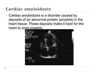 Cardiac amyloidosis
⦁ Cardiac amyloidosis is a disorder caused by
deposits of an abnormal protein (amyloid) in the
heart tissue. These deposits make it hard for the
heart to work properly.
 