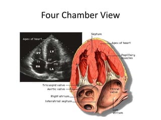 Four Chamber View
 