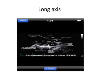 Long axis
 