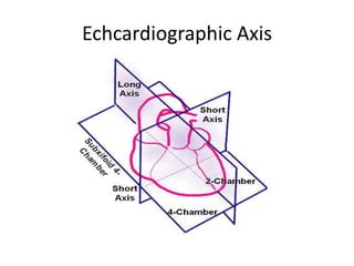 Echcardiographic Axis
 
