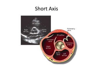 Short Axis
 