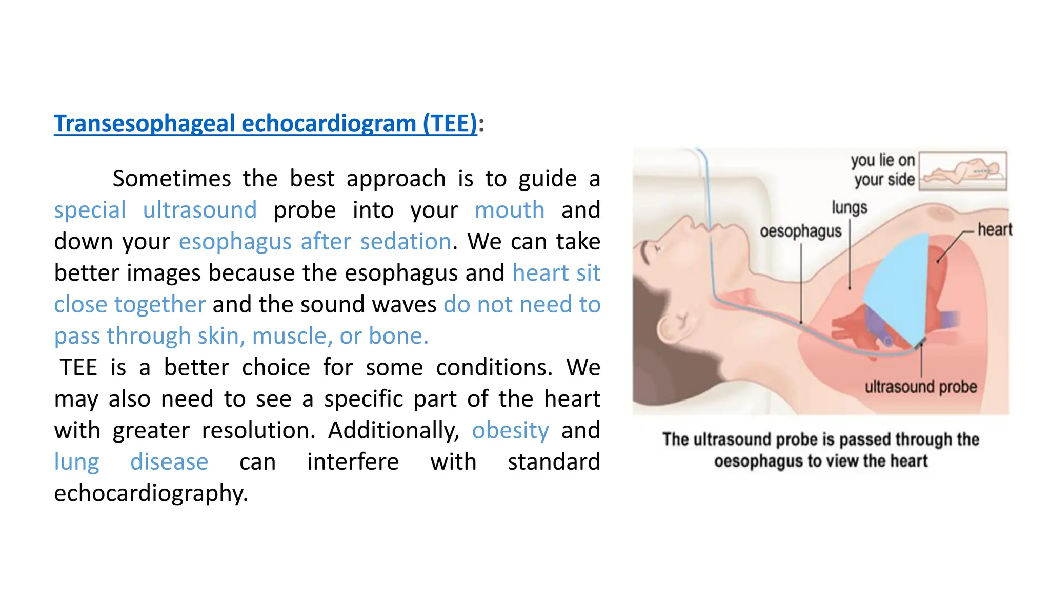 Transesophageal echocardiogram (TEE):
Sometimes the best approach is to guide a
special ultrasound probe into your mouth and
down your esophagus after sedation. We can take
better images because the esophagus and heart sit
close together and the sound waves do not need to
pass through skin, muscle, or bone.
TEE is a better choice for some conditions. We
may also need to see a specific part of the heart
with greater resolution. Additionally, obesity and
lung disease can interfere with standard
echocardiography.
 