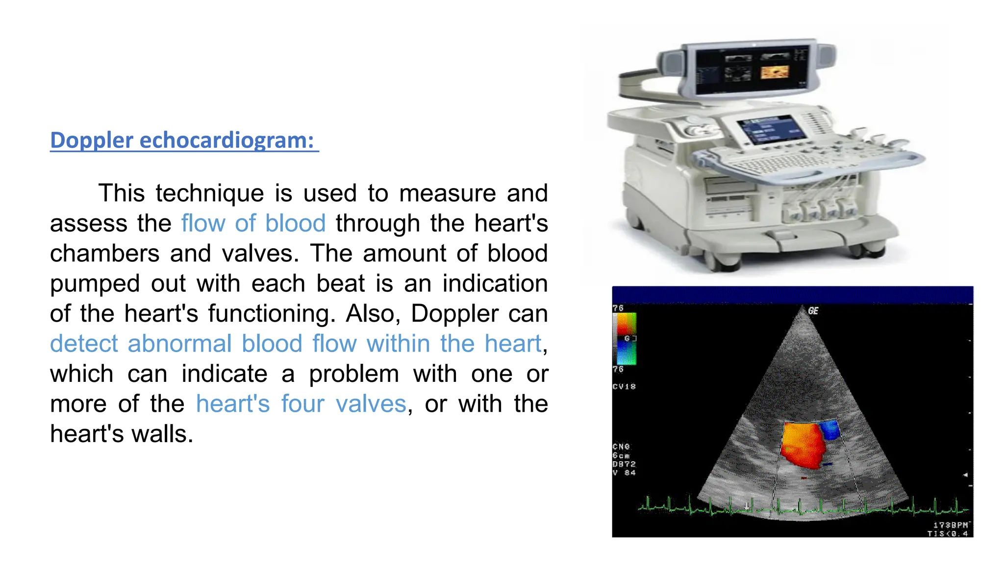 Doppler echocardiogram:
This technique is used to measure and
assess the flow of blood through the heart's
chambers and valves. The amount of blood
pumped out with each beat is an indication
of the heart's functioning. Also, Doppler can
detect abnormal blood flow within the heart,
which can indicate a problem with one or
more of the heart's four valves, or with the
heart's walls.
 