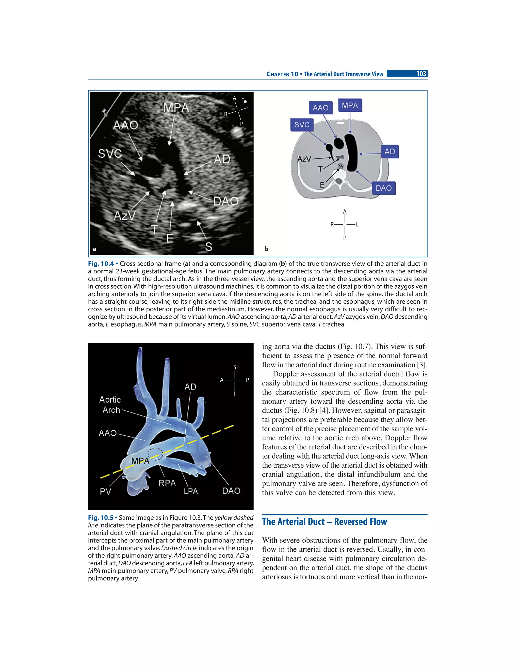 Echocardiographic anatomy in the fetus 2009 pg | PDF