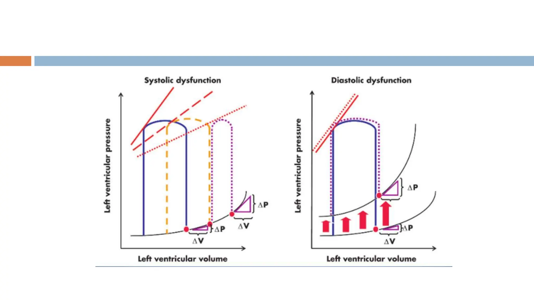 ECHOCARDIOGRAPHIC ASSESMENT OF DIASTOLIC FUNCTION.pptx
