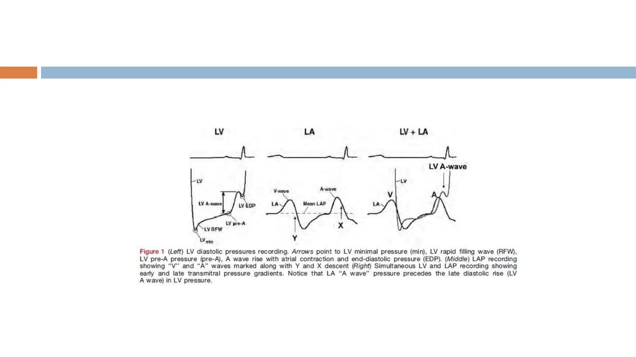 ECHOCARDIOGRAPHIC ASSESMENT OF DIASTOLIC FUNCTION.pptx