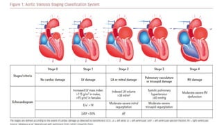 Sts Aortic Classification Echocardiographic evaluation of aortic valve and Aortic stenosis | PDF
