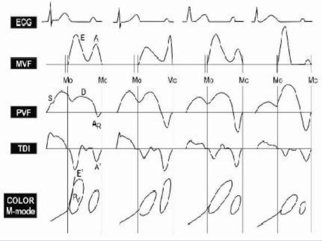 Echocardiographic evaluation of lv function