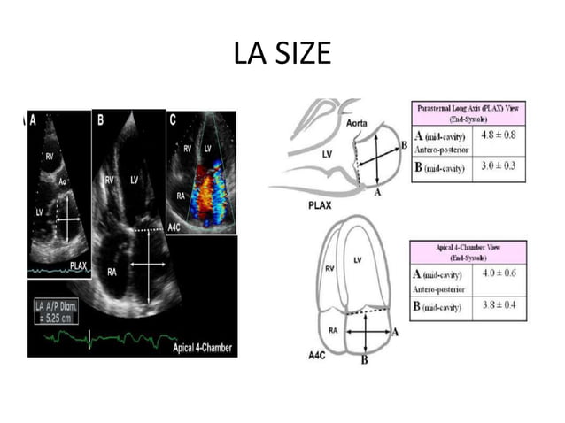 Echocardiographic evaluation of mitral regurgitation | PPTX | Heart and ...