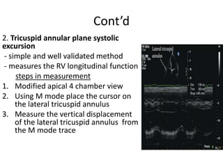 Echocardiographic measurements | PPTX