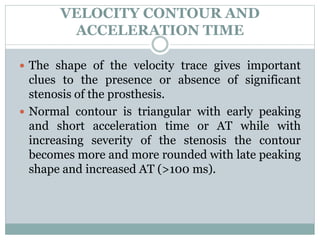 VELOCITY CONTOUR AND
ACCELERATION TIME
 The shape of the velocity trace gives important
clues to the presence or absence of significant
stenosis of the prosthesis.
 Normal contour is triangular with early peaking
and short acceleration time or AT while with
increasing severity of the stenosis the contour
becomes more and more rounded with late peaking
shape and increased AT (>100 ms).
 