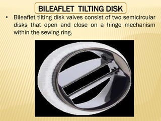 BILEAFLET TILTING DISK
• Bileaflet tilting disk valves consist of two semicircular
disks that open and close on a hinge mechanism
within the sewing ring.
 