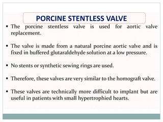 PORCINE STENTLESS VALVE
▪ The porcine stentless valve is used for aortic valve
replacement.
▪ The valve is made from a natural porcine aortic valve and is
fixed in buffered glutaraldehyde solution at a low pressure.
▪ No stents or synthetic sewing rings are used.
▪ Therefore, these valves are very similar to the homograft valve.
▪ These valves are technically more difficult to implant but are
useful in patients with small hypertrophied hearts.
 