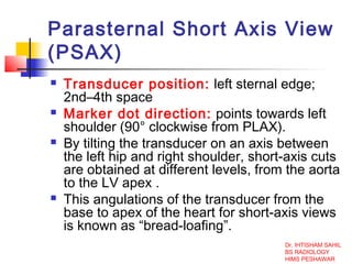 Echocardiography | PPT