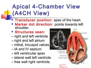 Apical Direction Echocardiography | PPT