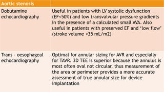 Echocardiography | PPTX