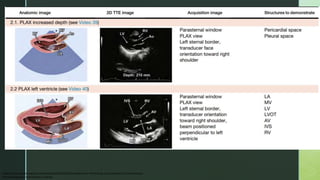 Echocardiography.pptx DATA ECHO BELAJAR ECHO | PPTX