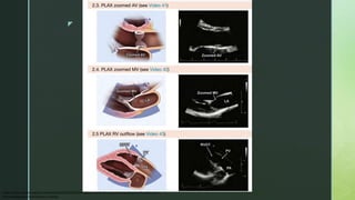 Echocardiography.pptx DATA ECHO BELAJAR ECHO | PPTX