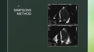 Echocardiography.pptx DATA ECHO BELAJAR ECHO | PPTX
