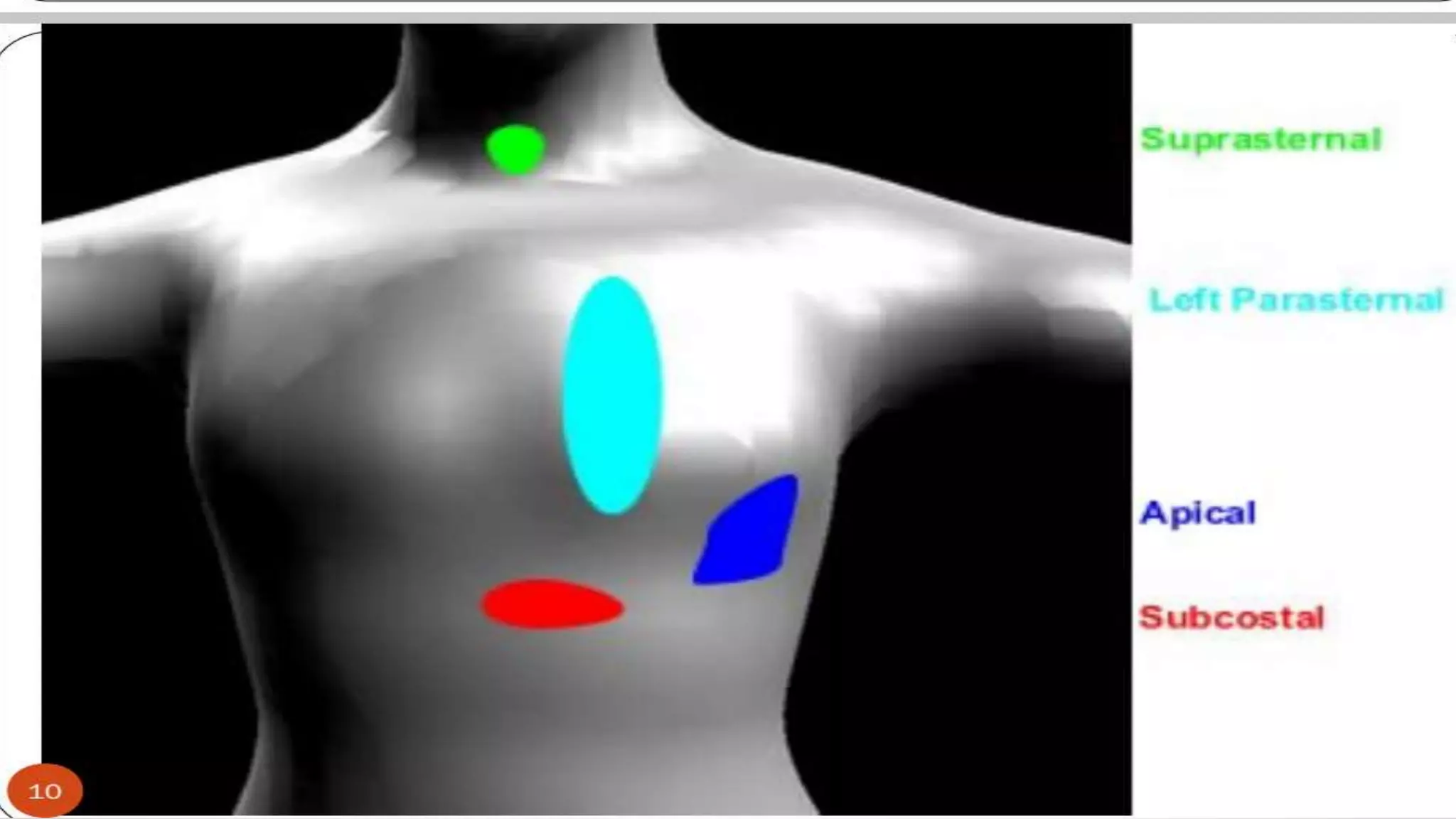 Echocardiography basics