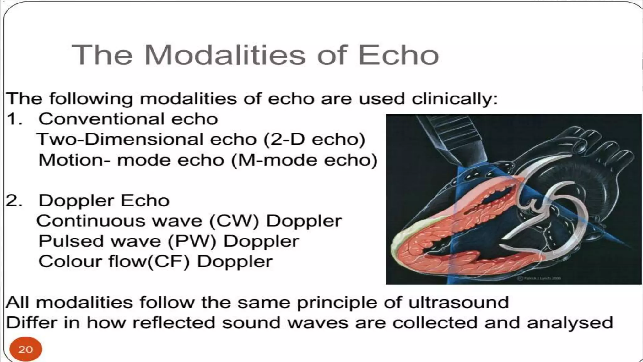 Echocardiography basics