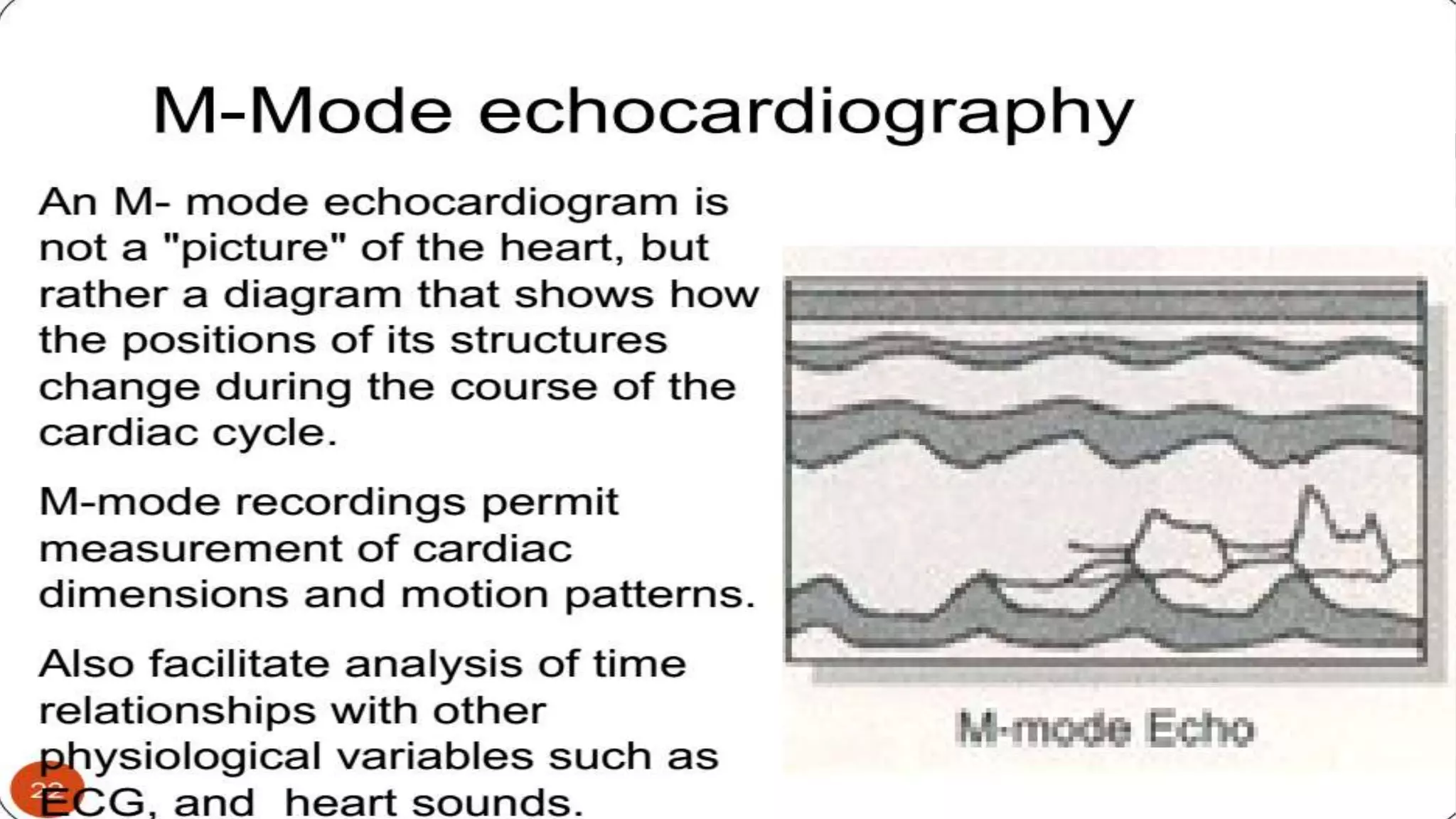 Echocardiography basics
