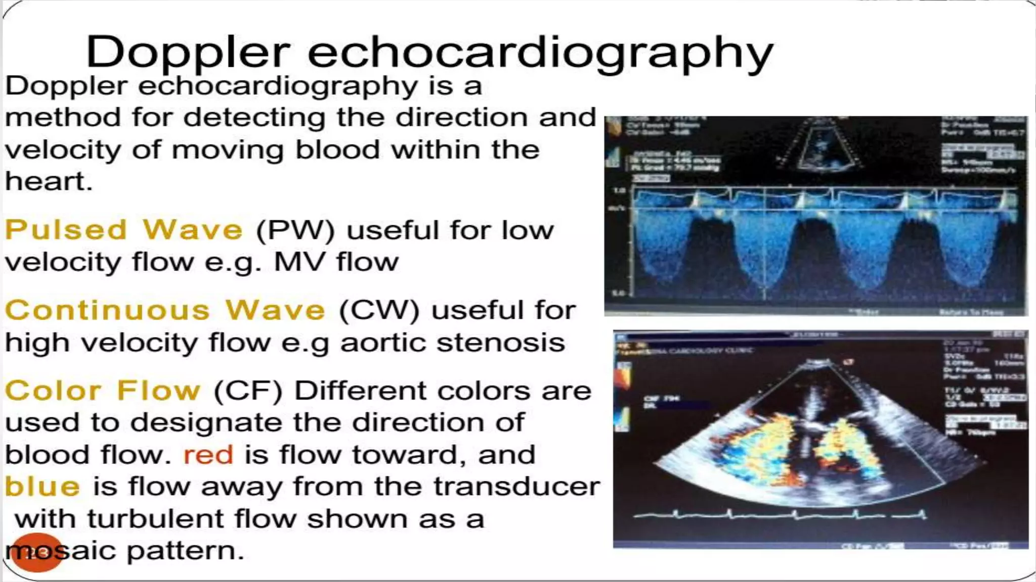 Echocardiography basics