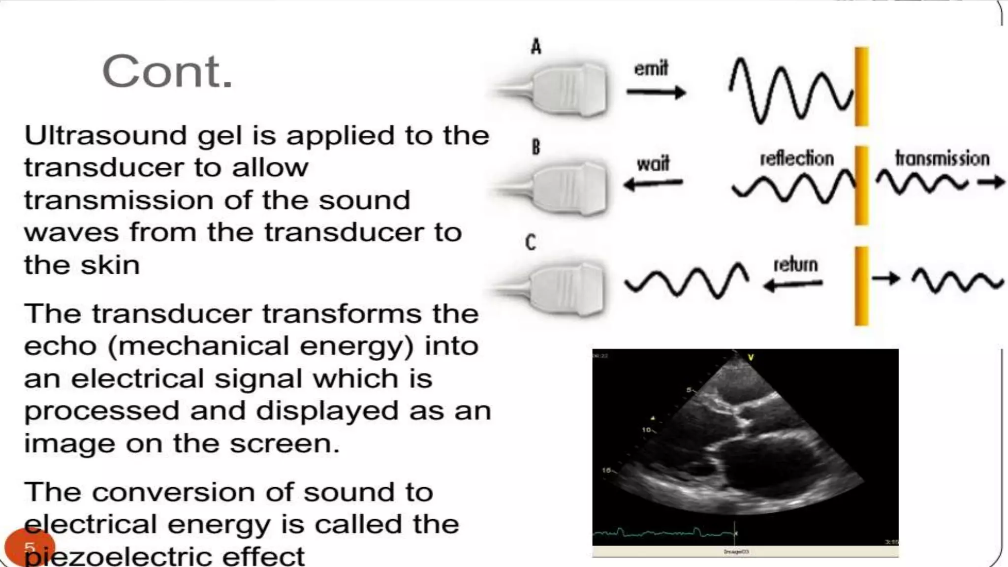 Echocardiography basics