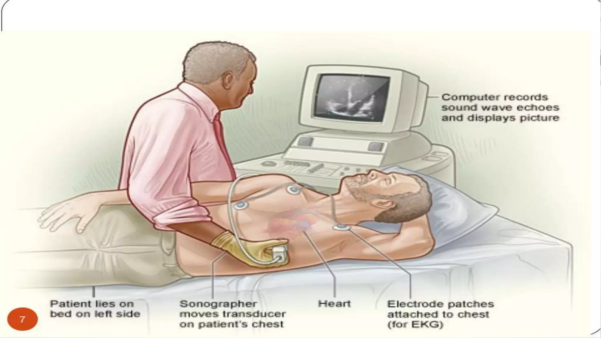 Echocardiography basics