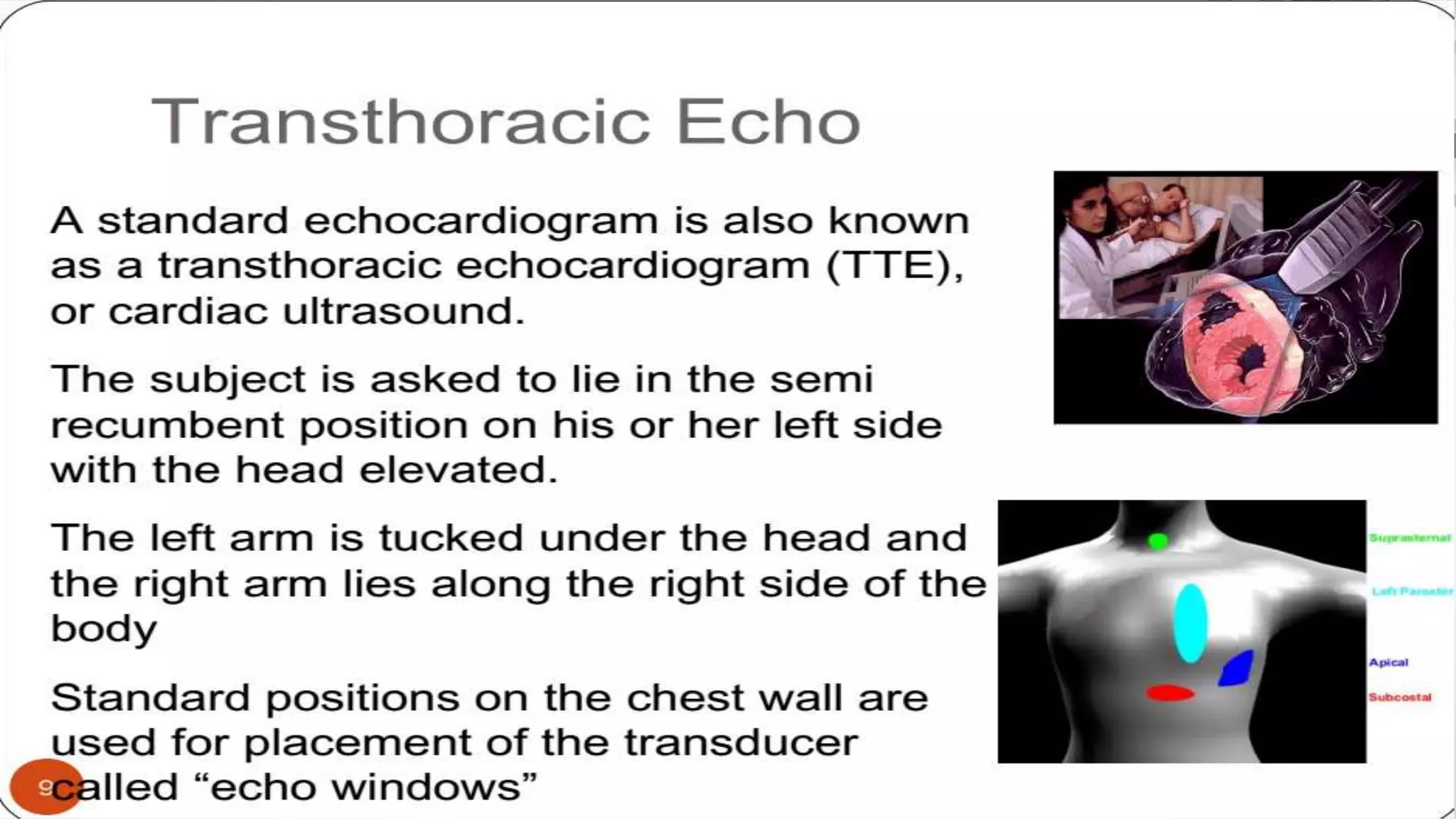 Echocardiography basics