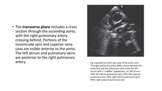 Echocardiography | PPTX