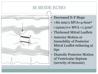 M MODE ECHO
 Decreased E-F Slope
 >80 mm/s MVA=4-6cm²
<15mm/s⇒ MVA <1.3cm²
 Thickened Mitral Leaflets
 Anterior Motion or
Immobility of Posterior
Mitral Leaflet-tethering at
tips
 Diastolic Posterior Motion
of Ventricular Septum
(severity of stenosis)
 