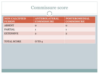 Commissure score
NON CALCIFIED
FUSION
ANTEROLATERAL
COMMISSURE
POSTEROMEDIAL
COMMISSURE
ABSENT 0 0
PARTIAL 1 1
EXTENSIVE 2 2
TOTAL SCORE O TO 4
 