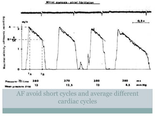 AF avoid short cycles and average different
cardiac cycles
 