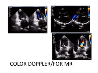 COLOR DOPPLER/FOR MR
 