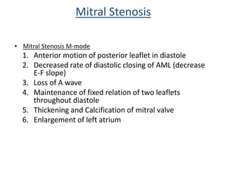 • Mitral Stenosis M-mode
1. Anterior motion of posterior leaflet in diastole
2. Decreased rate of diastolic closing of AML (decrease
E-F slope)
3. Loss of A wave
4. Maintenance of fixed relation of two leaflets
throughout diastole
5. Thickening and Calcification of mitral valve
6. Enlargement of left atrium
Mitral Stenosis
 