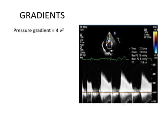 GRADIENTS
Pressure gradient = 4 v2
 