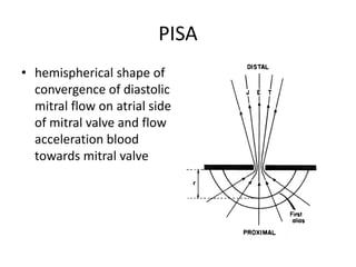 PISA
• hemispherical shape of
convergence of diastolic
mitral flow on atrial side
of mitral valve and flow
acceleration blood
towards mitral valve
 